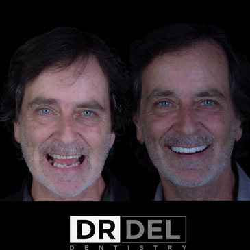 Slider image (7) DaVincis Dental Care Esthetic and Implant Dentistry